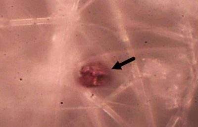 人类胎盘中发现了微塑料